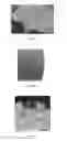 Fig. 02 - Needle-shaped cylinder liner and preparation method therefor, and coating liquid for preparing needle-shaped cylinder liner