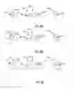 Fig. 09 - Extractor socket with bidirectional driving capability and corresponding extraction set with intermediate sizes