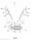 Fig. 06 - Sensorized robotic gripping device