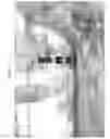 Fig. 12 - Elastic device of a motor-vehicle engine suspension