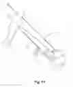 Fig. 12 - Trailer mounted capstan winch
