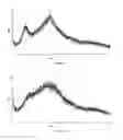 Fig. 08 - PROCESS FOR THE PREPARATION OF 5-[[[(2S)-2-AMINO-3-[4-(AMINOCARBONYL)-2,6-DIMETHYLPHENYL]-1-OXOPROPYL] [(1S)-1-(4-PHENYL-1H-IMIDAZOL-2-YL)ETHYL]AMINO] METHYL-2-METHOXYBENZOIC ACID AND ITS POLYMORPHS THEREOF