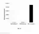 Fig. 11 - AKT-SPECIFIC CAPTURE AGENTS, COMPOSITIONS, AND METHODS OF USING AND MAKING