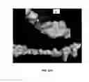 Fig. 30 - AKT-SPECIFIC CAPTURE AGENTS, COMPOSITIONS, AND METHODS OF USING AND MAKING