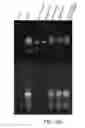 Fig. 22 - Antibodies specific for hyperphosphorylated tau and methods of use thereof