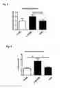 Fig. 04 - Method of treating extracellular tissue and vascular calcification and arteriosclerosis