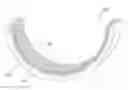 Fig. 01 - SLIDING ELEMENT FOR AN ENGINE COMPRISING SURFACE TREATED METAL PARTICULATE