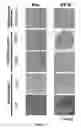 Fig. 07 - Stem cells derived from pure chorionic trophoblast layer and cell therapy comprising same