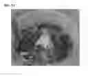 Fig. 02 - ALUMINUM ALLOY FOR DIE CASTING