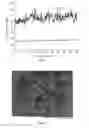 Fig. 02 - PRODUCTION METHOD OF A THICK COATING WITH LAYERED STRUCTURE