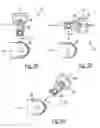 Fig. 05 - Safety locking device