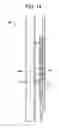 Fig. 15 - Methods and systems for a pin point frac sleeves system