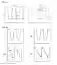 Fig. 09 - Diffractive optical element and light irradiation apparatus
