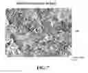 Fig. 07 - METHOD AND APPARATUS FOR CELL BLOCK PREPARATION OF CYTOLOGY SPECIMENS