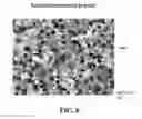 Fig. 08 - METHOD AND APPARATUS FOR CELL BLOCK PREPARATION OF CYTOLOGY SPECIMENS