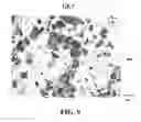 Fig. 09 - METHOD AND APPARATUS FOR CELL BLOCK PREPARATION OF CYTOLOGY SPECIMENS