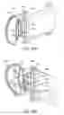 Fig. 71 - Electromagnetic shielding for magnetic resonance imaging methods and apparatus