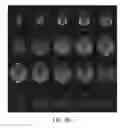 Fig. 74 - Electromagnetic shielding for magnetic resonance imaging methods and apparatus