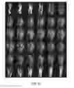 Fig. 75 - Electromagnetic shielding for magnetic resonance imaging methods and apparatus