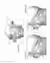 Fig. 06 - Enhancing the performance of near-to-eye vision systems
