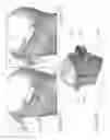 Fig. 07 - Enhancing the performance of near-to-eye vision systems