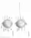 Fig. 34 - Enhancing the performance of near-to-eye vision systems