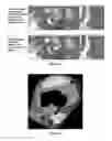 Fig. 13 - Quantitative imaging for cancer subtype