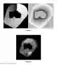 Fig. 14 - Quantitative imaging for cancer subtype