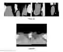 Fig. 15 - Quantitative imaging for cancer subtype
