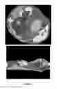 Fig. 16 - Quantitative imaging for cancer subtype