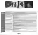Fig. 18 - Quantitative imaging for cancer subtype