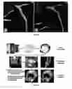 Fig. 22 - Quantitative imaging for cancer subtype