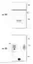 Fig. 17 - SYSTEMS AND METHODS OF UNIFORM REMOTE SIZING AND SELLING OF ARTICLES SUCH AS FOOTWEAR AND OTHER APPAREL