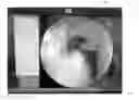 Fig. 01 - System and method for component positioning by registering a 3D patient model to an intra-operative image