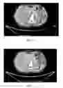 Fig. 09 - TOMOGRAPHIC RECONSTRUCTION WITH WEIGHTS
