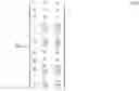 Fig. 11 - Enhancement of spatial audio signals by modulated decorrelation