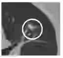 Fig. 01 - Medical imaging device- and display-invariant segmentation and measurement