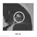 Fig. 02 - Medical imaging device- and display-invariant segmentation and measurement