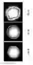 Fig. 07 - Medical imaging device- and display-invariant segmentation and measurement