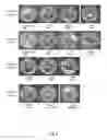 Fig. 06 - Quaternary disinfectant composition with anionic scale inhibiting agent