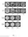 Fig. 07 - Quaternary disinfectant composition with anionic scale inhibiting agent