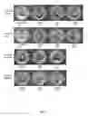 Fig. 08 - Quaternary disinfectant composition with anionic scale inhibiting agent