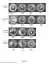 Fig. 09 - Quaternary disinfectant composition with anionic scale inhibiting agent