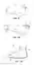 Fig. 07 - Footwear device