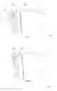 Fig. 04 - Profile for article of furniture, system of profiles for article of furniture and method for assembling an article of furniture