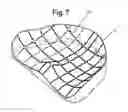 Fig. 07 - Cushioned load bearing surface and method for making same
