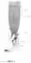 Fig. 06 - Squeezable fluid dispenser