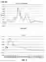 Fig. 07 - DETECTION OF CONCUSSION USING CRANIAL ACCELEROMETRY