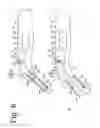 Fig. 07 - Intraoral moisture measuring device