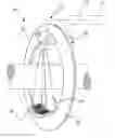 Fig. 01 - Computer tomography X-ray imaging